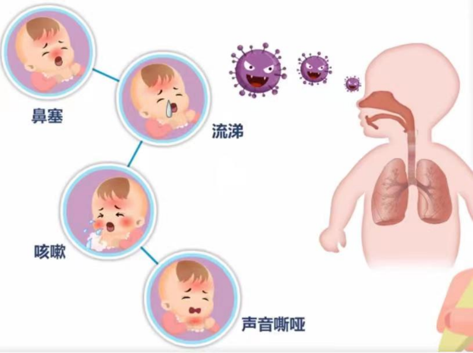 3岁女童同时感染3种呼吸道病毒