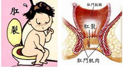 肛门周边瘙痒是怎么回事用什么药