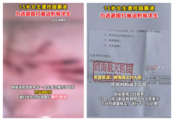 14岁女孩一次吞16颗处方药被送ICU