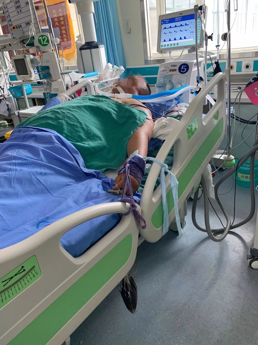 27岁小伙凌晨上吐下泻进ICU